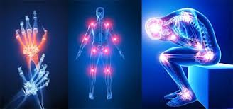 Osteofiti e speroni ossei nell'articolazione - PROTOCOLLO NUTRIZIONALE PER OSTEOFITOSI