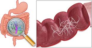 Parassiti intestinali al microscopio (elminti e protozoi) - PROTOCOLLO DEPARASSITANTE