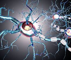Cervello umano con lesioni demielinizzanti - Neuroscienze Sclerosi Multipla