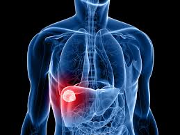 Illustrazione fegato umano con evidenza rigenerazione cellulare - Supporto oncologico